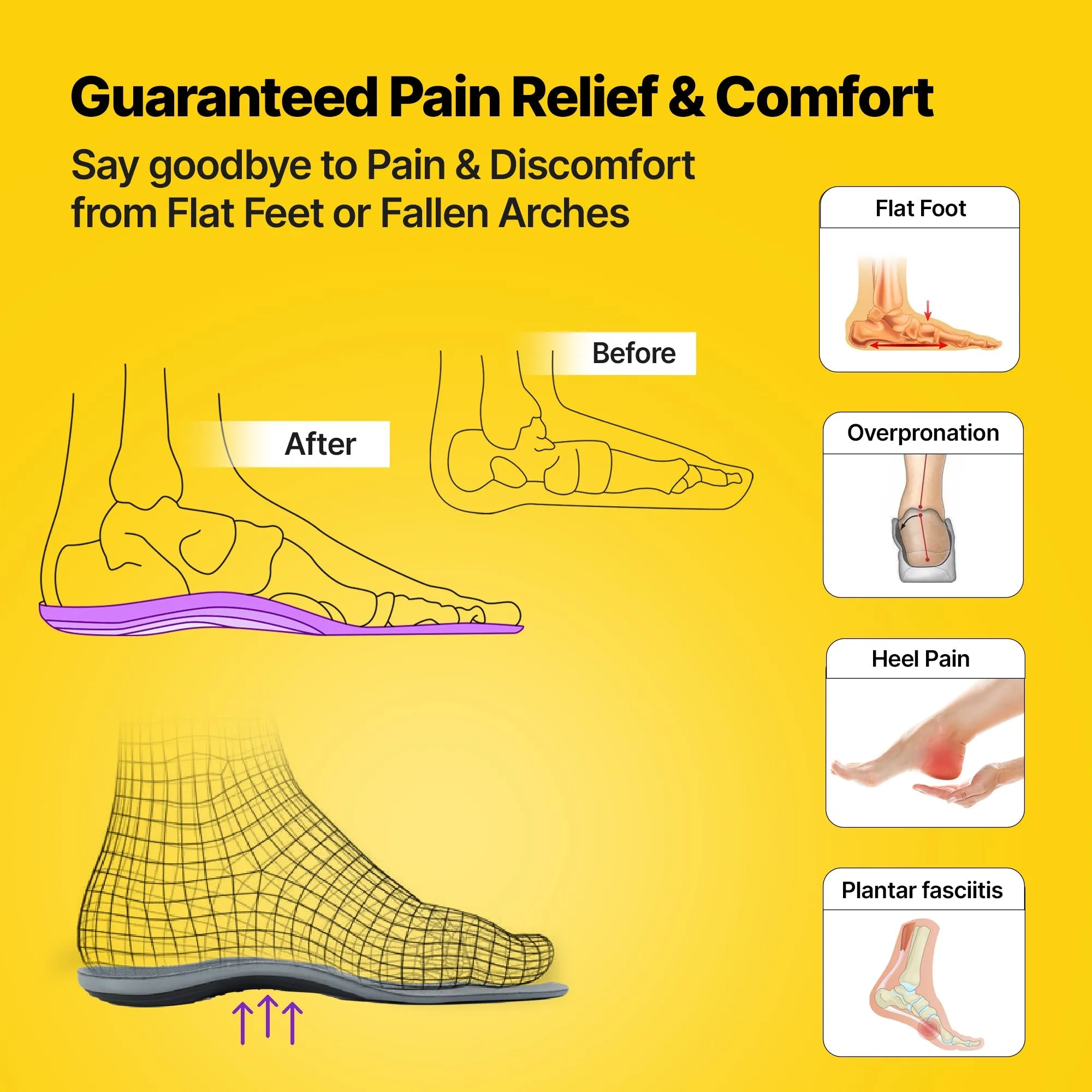 AC - Frido Arch Support Insole - Semi Rigid